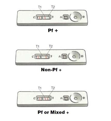 Malaria RDT Test One