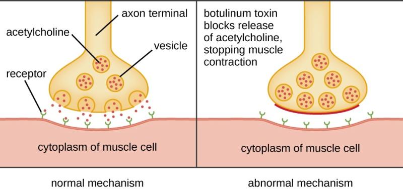 Mechanism of Botulinum toxin - Mechanism of Botulinum toxin(Image source: lumenlearning.com)