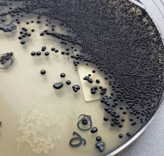 Tinsdale Agar Medium - Colonies ofC. diphtheriaein Tinsdale Agar