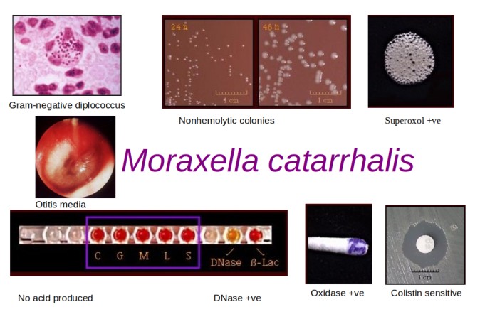  - Important properties ofMoraxella catarrhalis