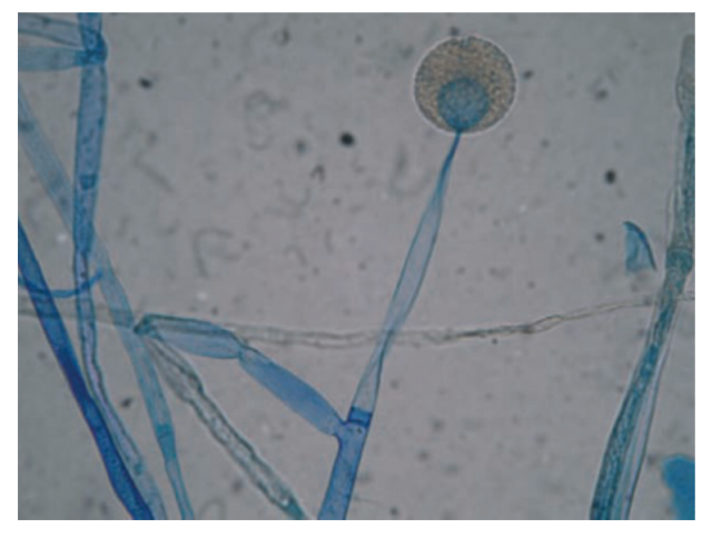 Microscopic feature of Mucor sp. in  LPCB mount - Microscopic feature ofMucor sp. in culture. Lactophenolcotton blue staining shows a globose intact sporangium with sporangiospores and branched sporangiophores. (Imagesource)