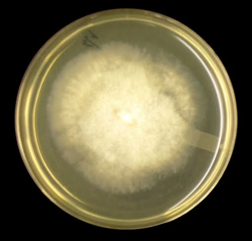 Mucor on SAB Agar plate 48hrs at 30°C - Mucor on SAB Agar plate 48hrs at 30°C (source)