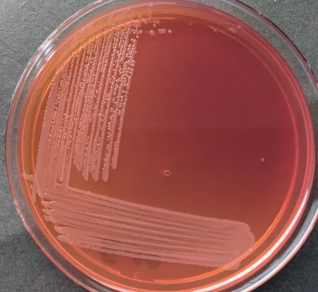 Pale, non-lactose fermenting colonies of Salmonella in MacConkey Agar - Pale, non-lactose fermenting colonies ofSalmonellain MacConkey Agar