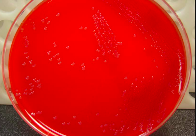 Neisseria meningitidis in Blood Agar - Neisseria meningitidisin Blood Agar