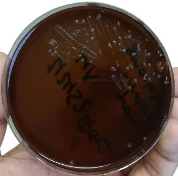 Neisseria gonorrhoeae in New York City Medium - Neisseria gonorrhoeae in New York City Medium(Imagesource)