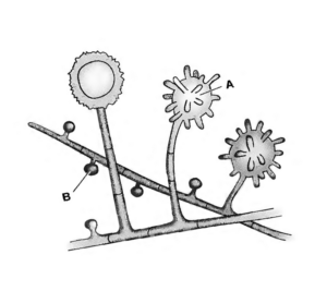  - Asexual spores ofH.capsulatumA: Tuberculate macroconidia B: Microconidia