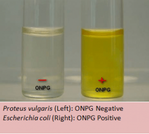 ONPG Test results - ONPG Test results