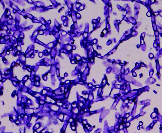 PAS stain (fungal staining technique) - Periodic Acid-Schiff showing fungal hyphaImage source: DOI:10.1155/2011/821259