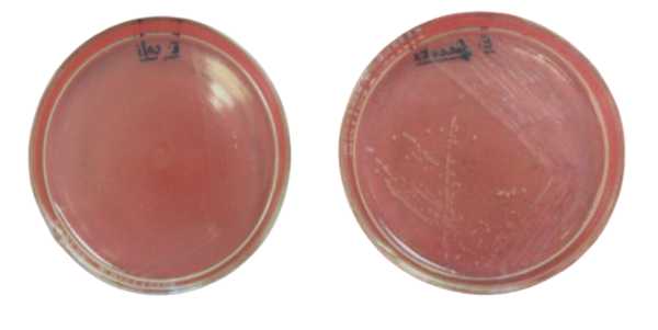  - PEA agar plates without blood incubated at 48 hours at 35°CLeft:Escherichia coli.Right:Enterococcus faecalisImage source: Cheeptham and Farday, ASM MicrobeLibrary