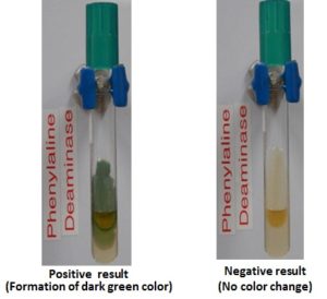 Phenylalanine deaminase test results - Phenylalanine deaminase test results(Source: microbugz)