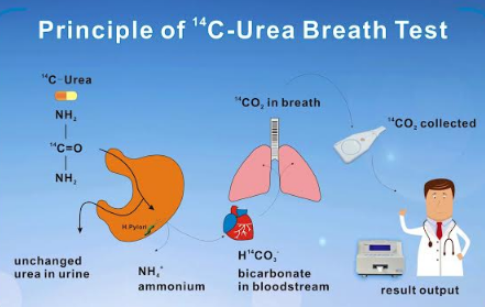  - Urea Breath Test Principle (Image source; Headway)