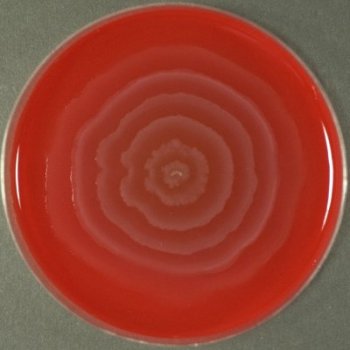  - Swarming in Blood Agar (Source)