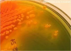  yellow-orange colonies of Proteus vulgaris in Hektoen Enteric Agar - Yellow-orange colonies ofProteus vulgarisin Hektoen Enteric Agar