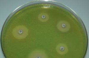 Pseudomonas aeruginosa growing on Mueller Hinton Agar - Pseudomonas aeruginosa(green color) growing onMueller Hinton Agar