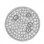 Quadrinucleate cyst of Entamoeba histolytica - Quadrinucleate cyst ofEntamoeba histolytica