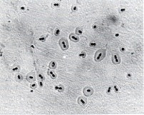 S. pneumoniae shows Quellung positive reaction - Streptococcus pneumoniaeshows a quellung positive reaction.