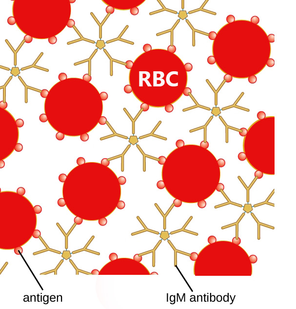 IgM Antibody cross links antigens present in RBCs thus producing hemagglutination - Hemagglutination