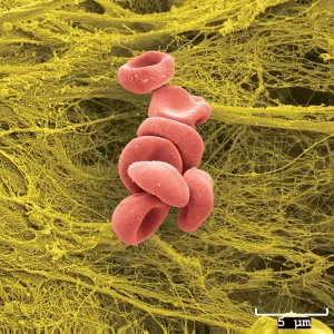 RBC seen in Scanning Electron Microscope - RBC seen in Scanning Electron Microscope(Image source: University of Iowa)