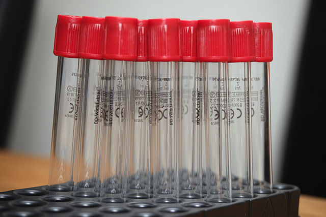 Red colored tube - Red Vacutainer