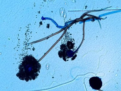 Mature sporangium of Rhizopus releasing sporangiospores - Mature sporangium ofRhizopusreleasing sporangiospores (source)