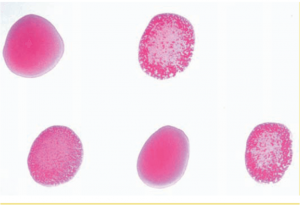 Rose Bengal plate test - Rose Bengal plate test