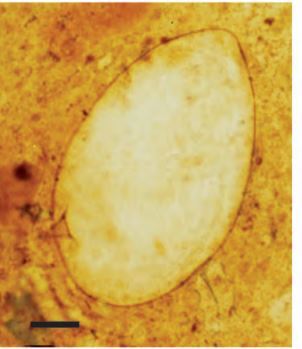 S mansoni egg in Kato-Katz Preparation  - S mansoniegg in Kato-Katz Preparation