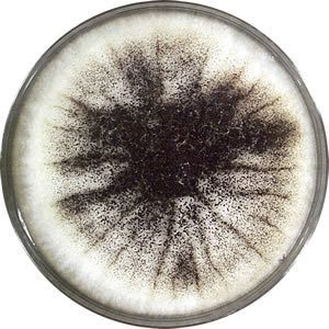 Mold colony with Black pigmentation in SDA - Mold colony with black pigmentation in SDA