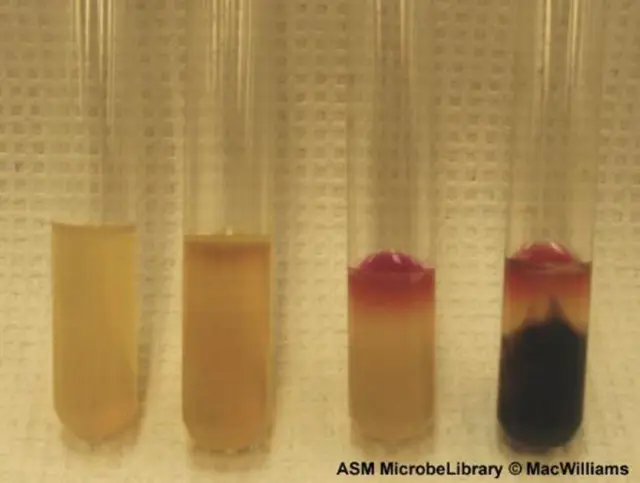 sulfur-indole-motility (SIM) agar - sulfur-indole-motility (SIM) agar