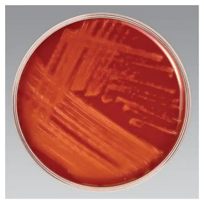 SXT Blood agar with heavy growth  - SXT Blood agar with heavy growth of beta hemolytic streptococci