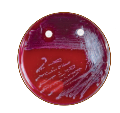 SXT and Bacitracin sensitivity test - SXT-Bacitracin test forStreptococcus pyogenes.Bacitracin is on the left (S) and SXT on the right (R)