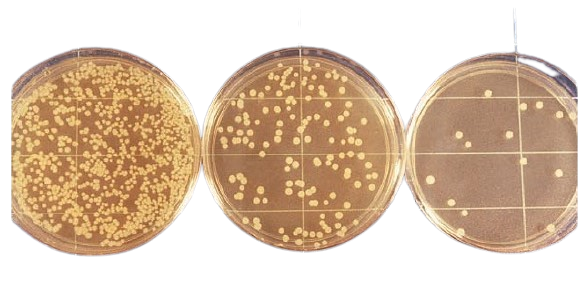 Agar plates plated with serial dilution of test sample - Agar plates plated with serial dilution of the test sample
