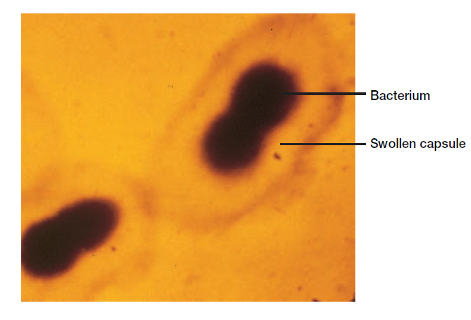  - Serotyping ofStreptococcus pneumoniae