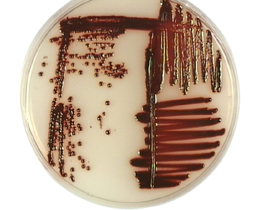Red colonies of Serratia marcescens in Tryptic Soy Agar - Serratia marcescensgrew as bright, glossy red colonies on the TSA plate (Imagesource)