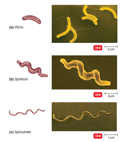  - Spiral-shaped bacteria (Image source: Ref-3)