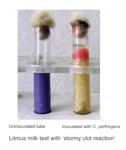 Stormy clot reactions by Clostridium perfringens