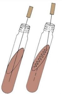 Inoculation in TSI Agar - Inoculation in TSI agar