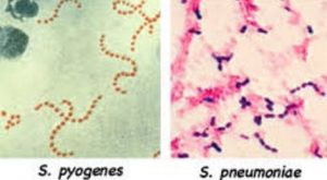 Streptococcus spp   (S. pyogenes and S. pneumoniae) - Streptococcus spp (S. pyogenes and S. pneumoniae)