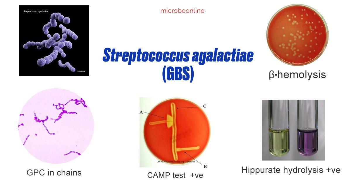 Properties of Streptococcus agalactiae