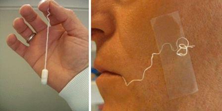 From left to right: Entero-Test device prior to swallowing, Entero-Test in situ - From left to right: Entero-Test device prior to swallowing, Entero-Test in situ (image source: Guiney WJ et al British Journal of Clinical Pharmacology)