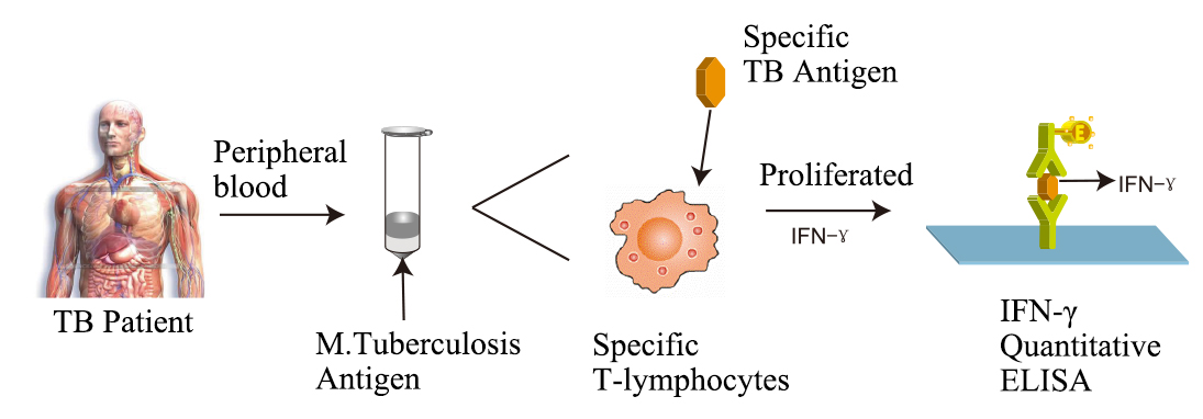 Interferon-Gamma Release Assays (IGRA) Image source: invitro-test.com - Interferon-Gamma Release Assays (IGRA)Image source: invitro-test.com