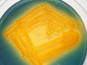yellow colored colonies of Vibrio cholorae in TCBS culture medium - Yellow-colored colonies ofVibrio choleraein TCBS culture medium