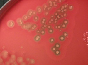 Double Zone hemolysis produced by Clostridium perfringens  - Double zone hemolysis produced byClostridium perfringens