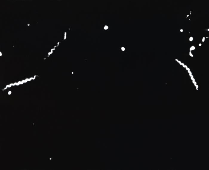 Treponema pallidum in Dark-field microscope which exhibited their characteristic corkscrew shape. - Treponema pallidumin Dark-field microscope which exhibited their characteristic corkscrew shape.Source: Source:https://phil.cdc.gov/Details.aspx?pid=20488