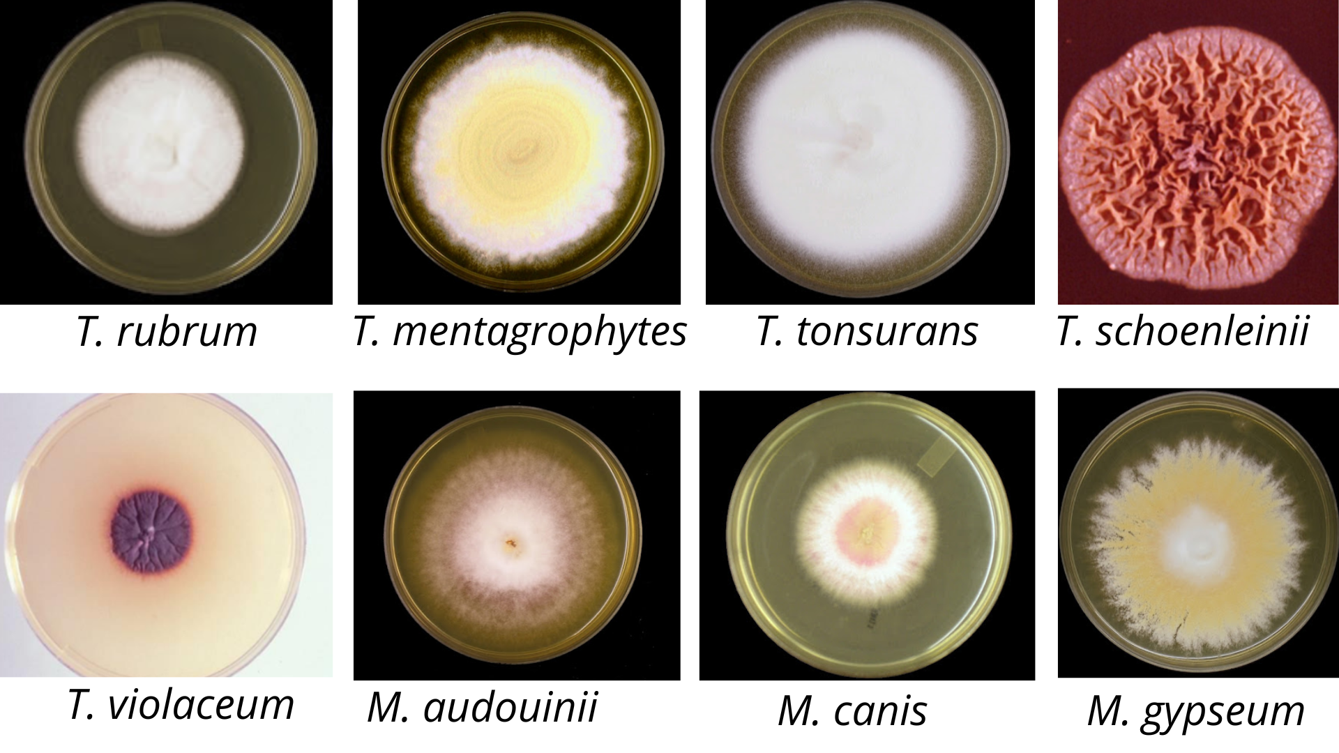 Colony morphology of Trichophyton and Microsporum - Colony ofTrichophytonandMicrosporum