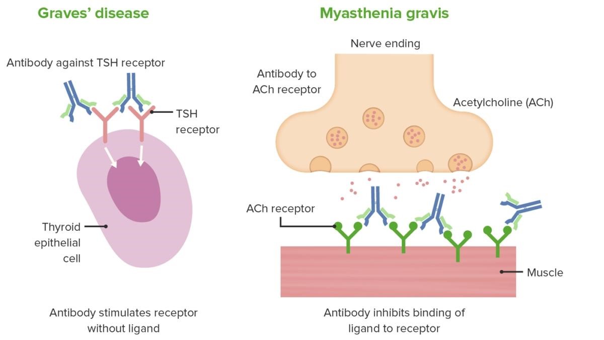 clinical manifestation of type II hypersensivity - Image source:https://www.lecturio.com/concepts/type-ii-hypersensitivity-reaction/