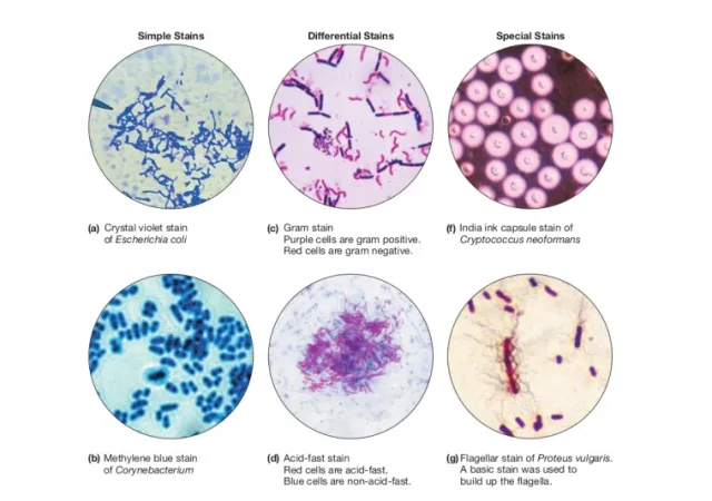  - Types of Microbiological Stains (Image source: Ref-3)