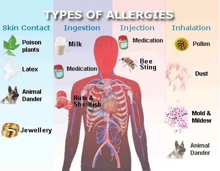 Types of allergies - Types of allergies
