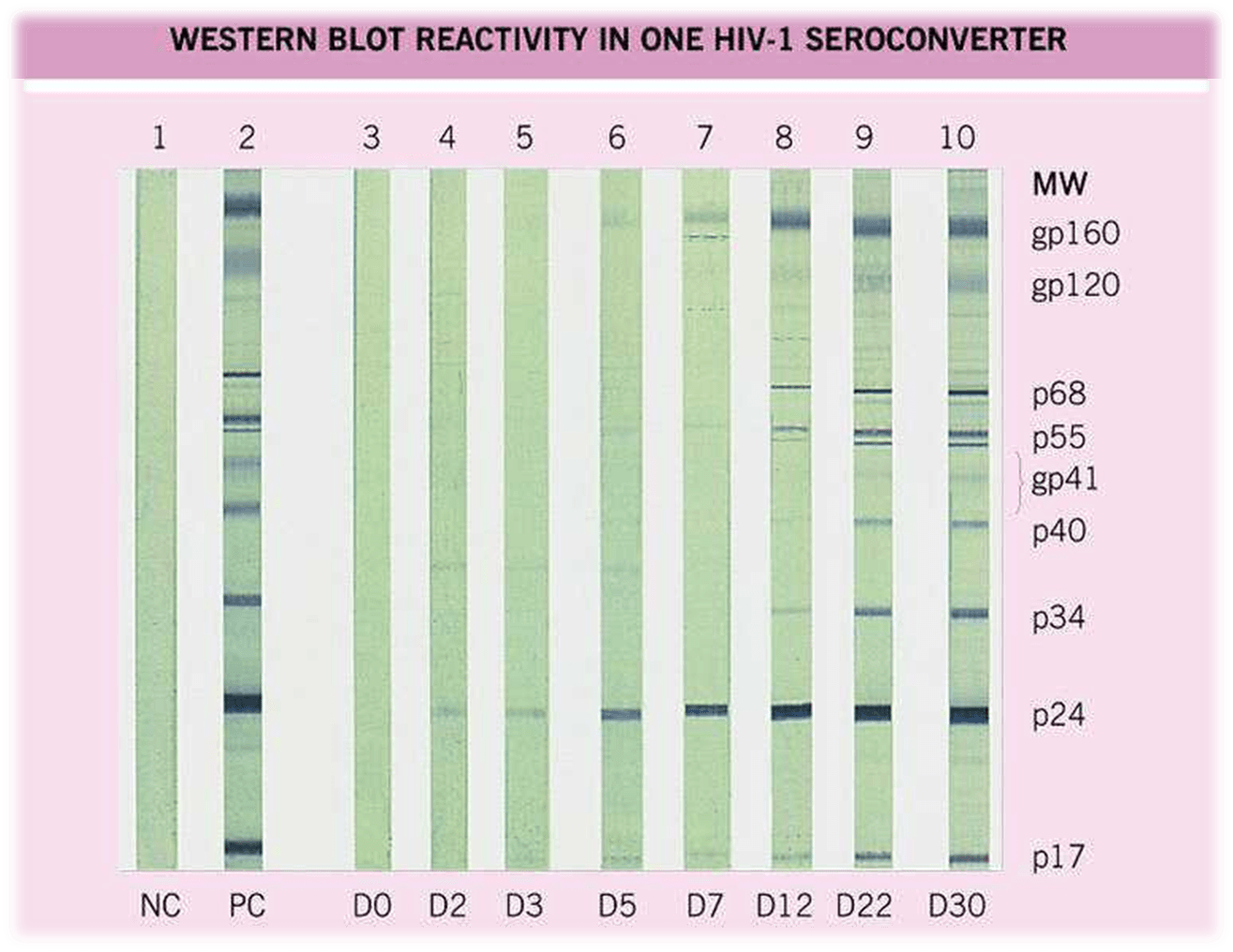 Western Blot for HIV diagnosis - Western Blot Test forHIV diagnosis