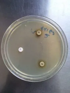 X and V Factor: Growth is seen around XV Factor only. - X and V Factor: Growth is seen around XV Factor only.