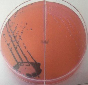 XLD Cultures: Left: Red-pink black centered colonies of Salmonella typhimurium  Right: Red-pink Shigella colonies - XLD Cultures:Left: Red-pink black centered colonies of Salmonella typhimuriumRight: Red-pink Shigella colonies